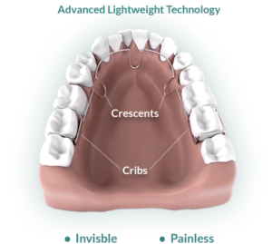 ALF Orthodontics in Encino Woodland Hills CA