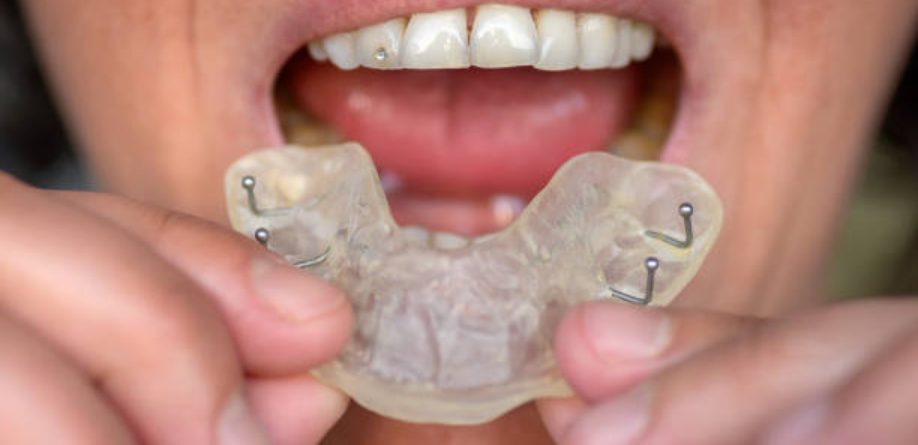 Oral Appliance Therapy