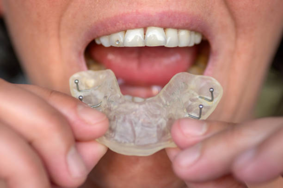 Oral Appliance Therapy